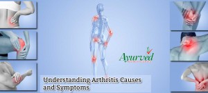 Herbal Arthritis Relief Supplements and Oil Ayurvedic Treatment for Arthritis Pain