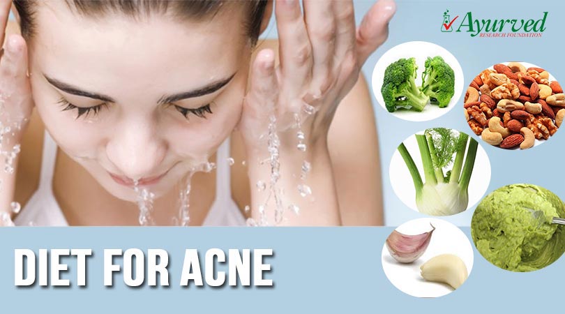 Diet for Acne Prevention