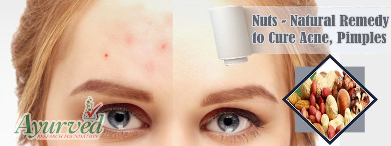 Nuts Natural Remedy to Cure Acne Pimples