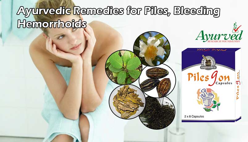 Ayurvedic Remedies for Piles, Bleeding Hemorrhoids Herbal