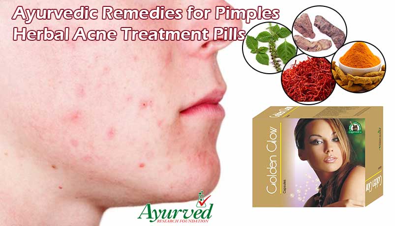 Ayurvedic Remedies for Pimples Treatment