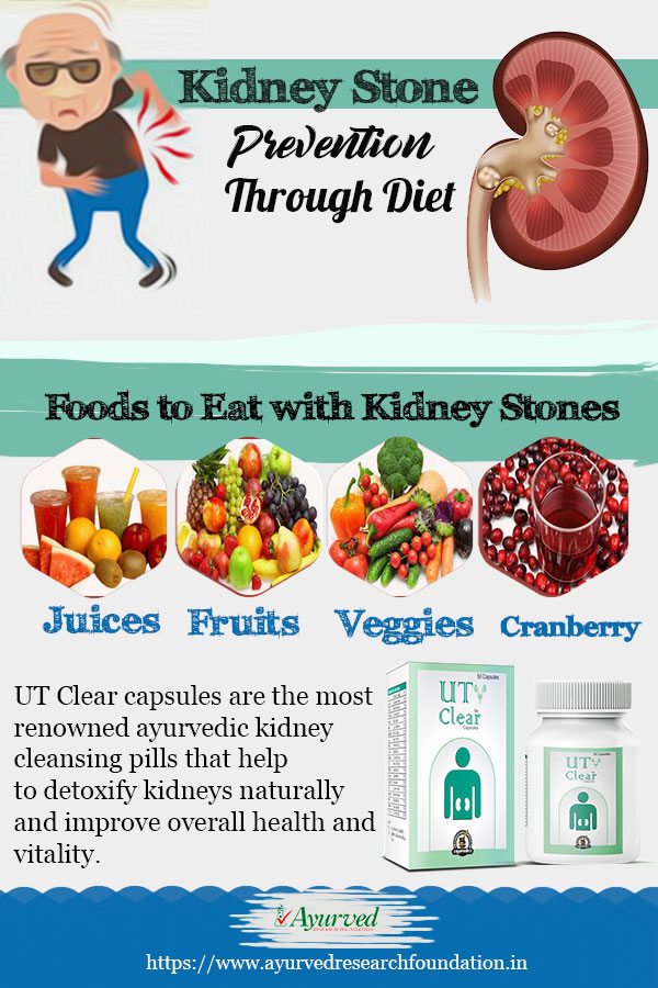 Diet to Prevent Kidney Stones