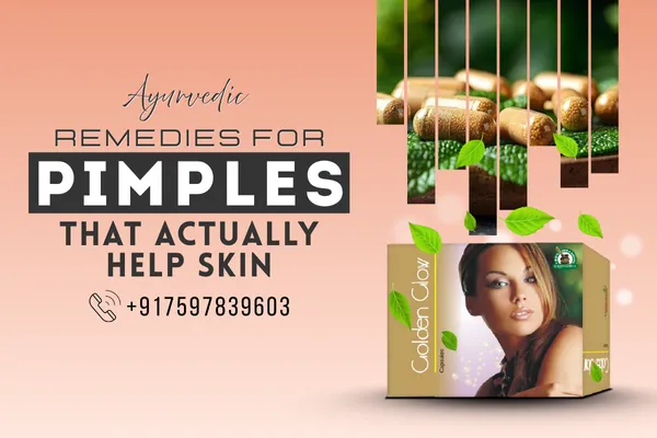 Effective natural remedies for pimples and acne