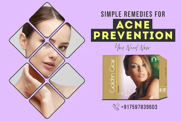 Capsules for Clear Skin and Acne Control, Herbal Supplements for Acne-Free Complexion